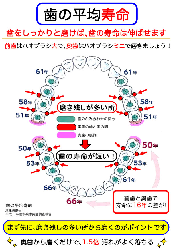 歯の寿命