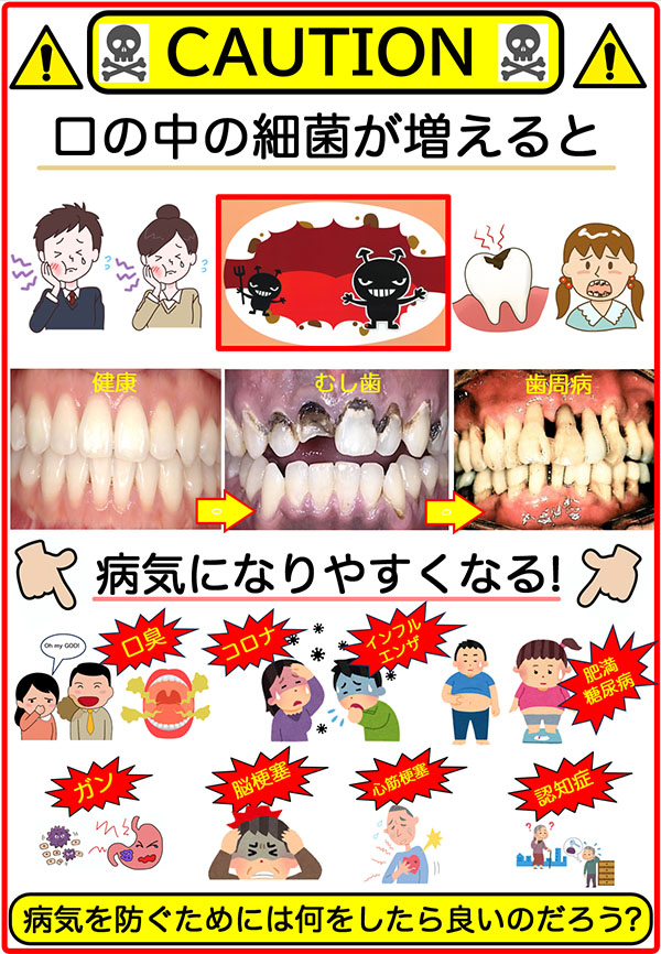 口の中の細菌が増えると病気になりやすくなる！