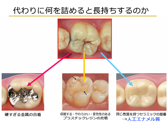 代わりに何を詰めると長持ちするのか